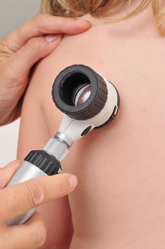 Skin Checks & Early Detection