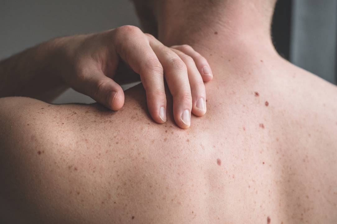 Skin Cancer Treatment Banner